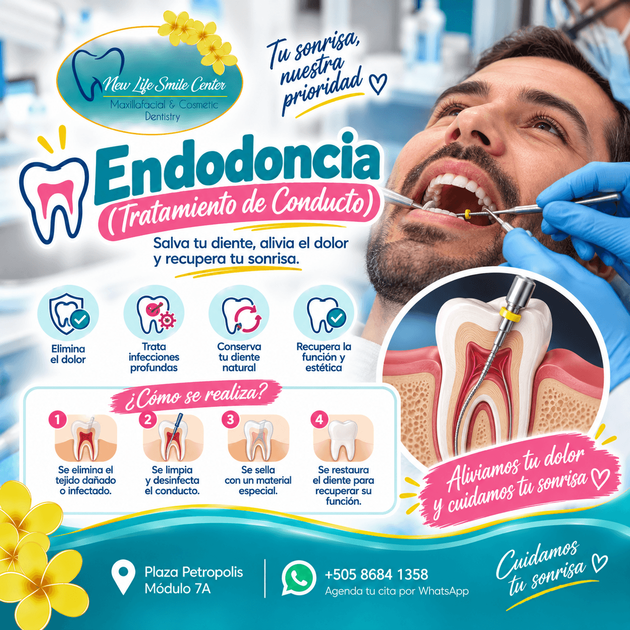 Endodoncia (Tratamiento de Conducto)