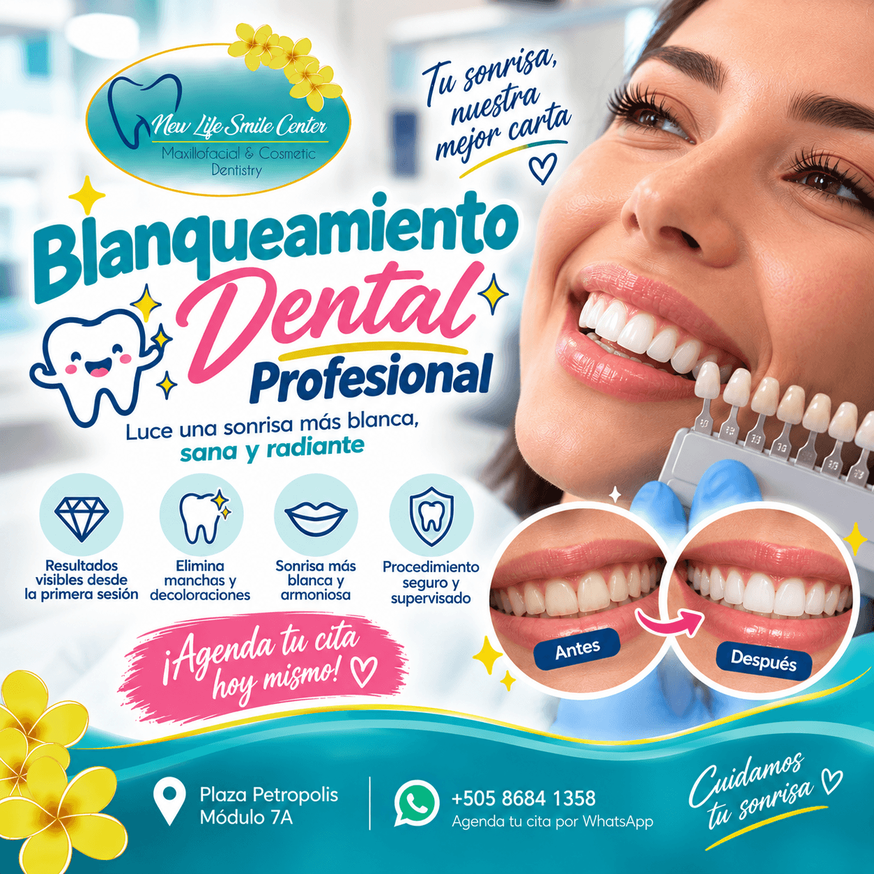Blanqueamiento Dental Profesional