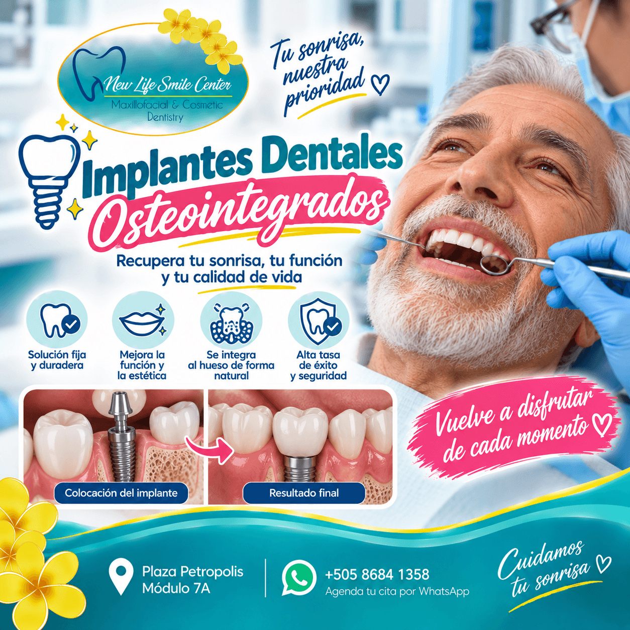 Implantes Dentales Osteointegrados
