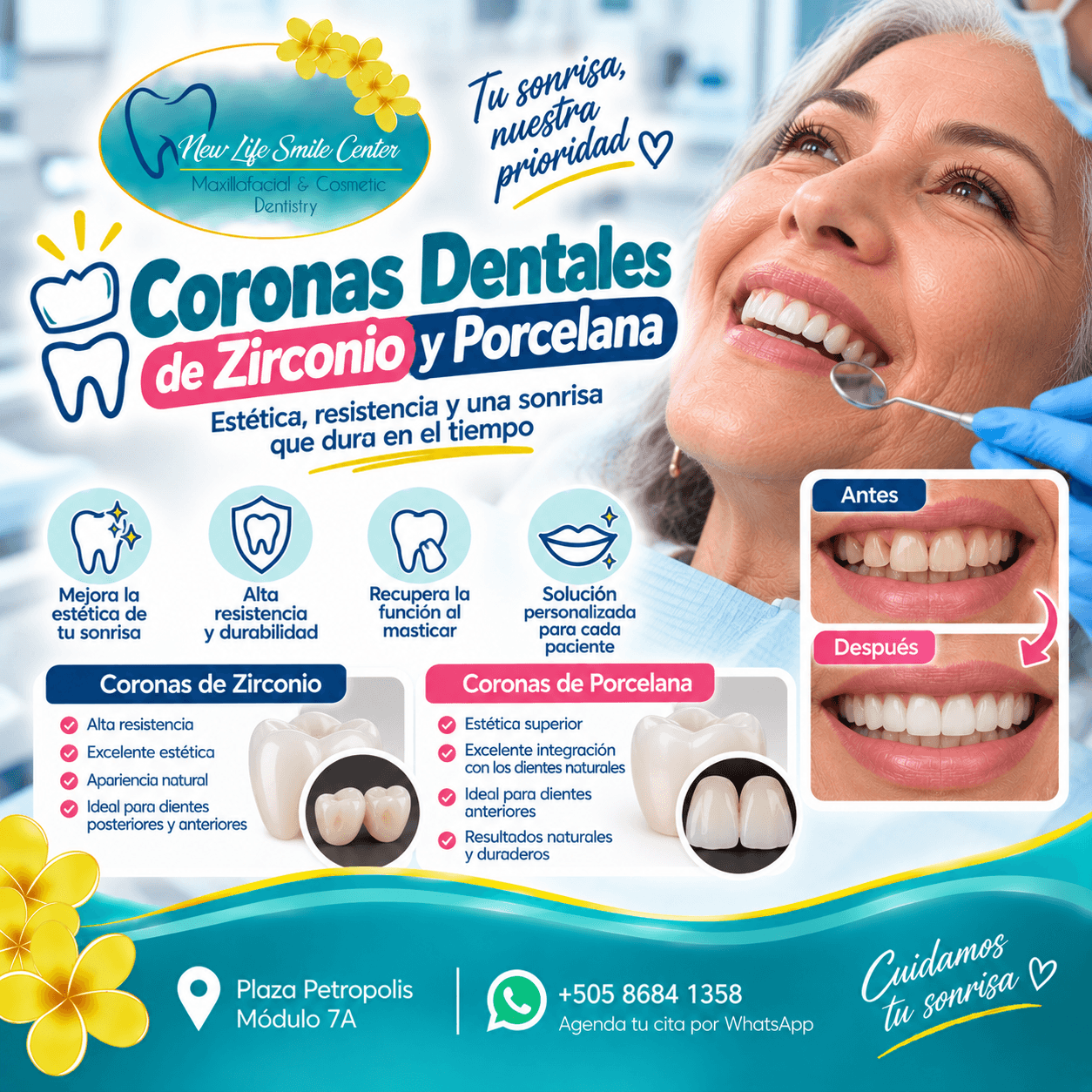 Coronas Dentales de Zirconio y Porcelana